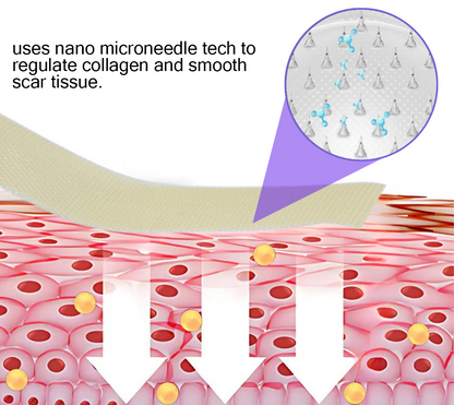 Official Store: ReGen Microneedles Pro Patches with Hyaluronic Acid Nano-Heal Treatment for new and old scars, reduction of surgical scars, stretch marks, keloids, acne, burns, warts, dermatomas, and varicose veins