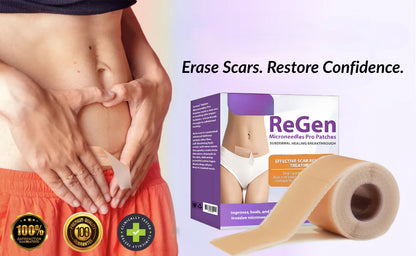 Official Store: ReGen Microneedles Pro Patches with Hyaluronic Acid Nano-Heal Treatment for new and old scars, reduction of surgical scars, stretch marks, keloids, acne, burns, warts, dermatomas, and varicose veins