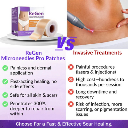 Official Store: ReGen Microneedles Pro Patches with Hyaluronic Acid Nano-Heal Treatment for new and old scars, reduction of surgical scars, stretch marks, keloids, acne, burns, warts, dermatomas, and varicose veins